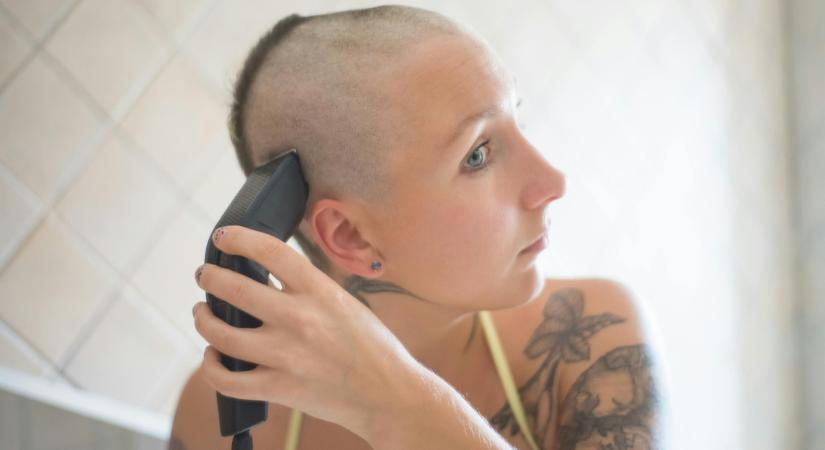 "Órákig sírtam": Munkahelyi stressz okozta a fiatal nő gyógyíthatatlan hajhullását