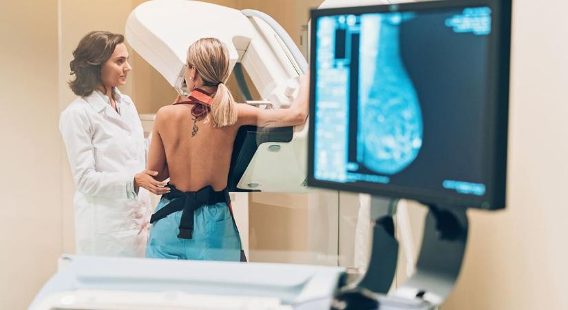 Kétévente 20 perc, ér ennyit az életed? – Tévhitek miatt hagyjuk ki a mammográfiát