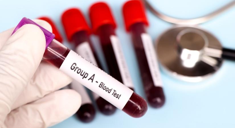 Neked is ez a vércsoportod? Akkor valószínűleg nehezebben fogysz, de akár 10 évvel is tovább élhetsz, mint mások