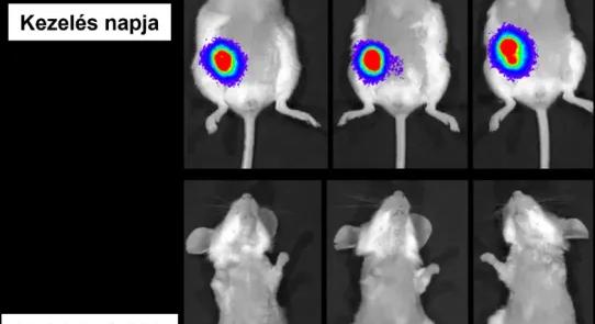 Magyar csoda a rákgyógyításban: az új szer teljesen eltüntette a daganatot!