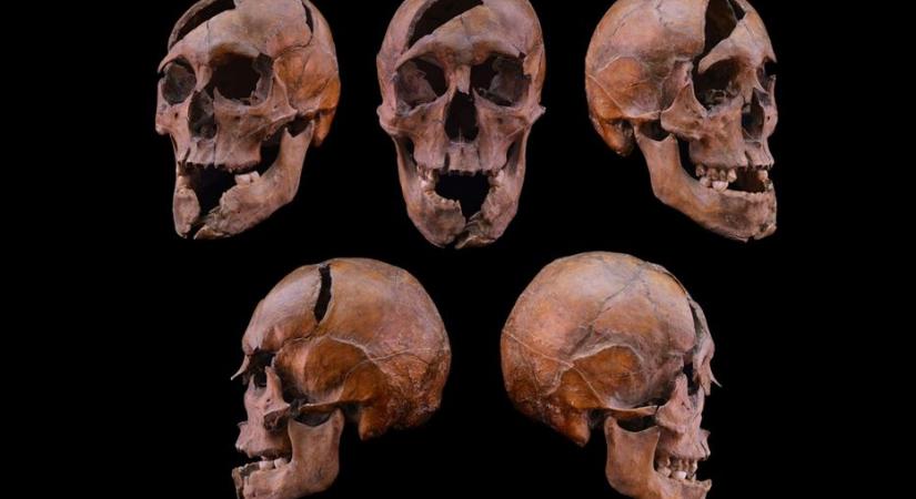 Gyilkosság áldozata lett – azonosították az Árpád-házi macsói Béla herceg maradványait