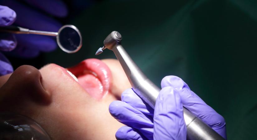 Váratlan veszélyt okozhatnak a lyukas fogak – Íme a legerősebb érv a helyes fogápolás mellett