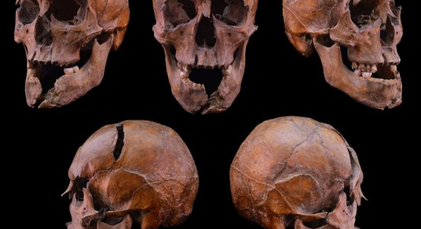 Brutális gyilkosság áldozata lett a magyar herceg a Margit-szigeten