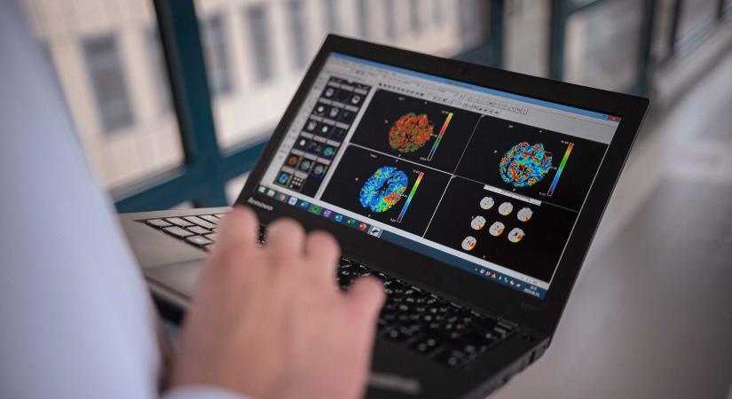 A radiológusokat inkább a létszámhiány fenyegeti, mint az MI