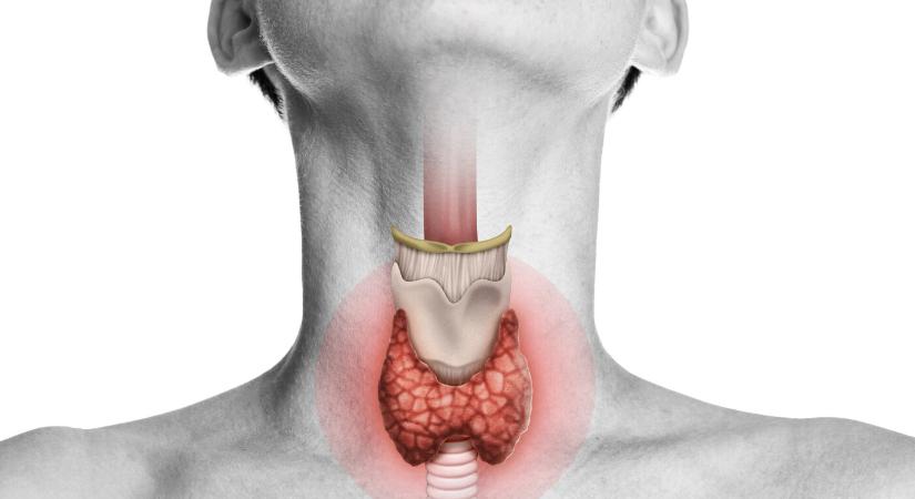 Sokan nem tudják, hogy alulműködik a pajzsmirigyük – ezek a fő jelek