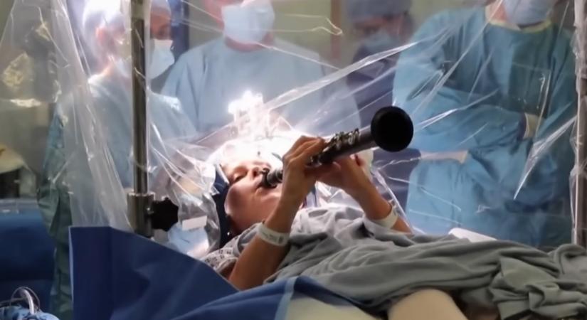 Lyukat fúrtak a nő agyába, miközben ő klarinétozott – videó