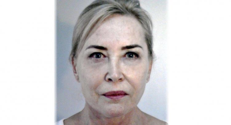 Megműtötték, majd eltűnt egy orvosnő a szegedi kórházból