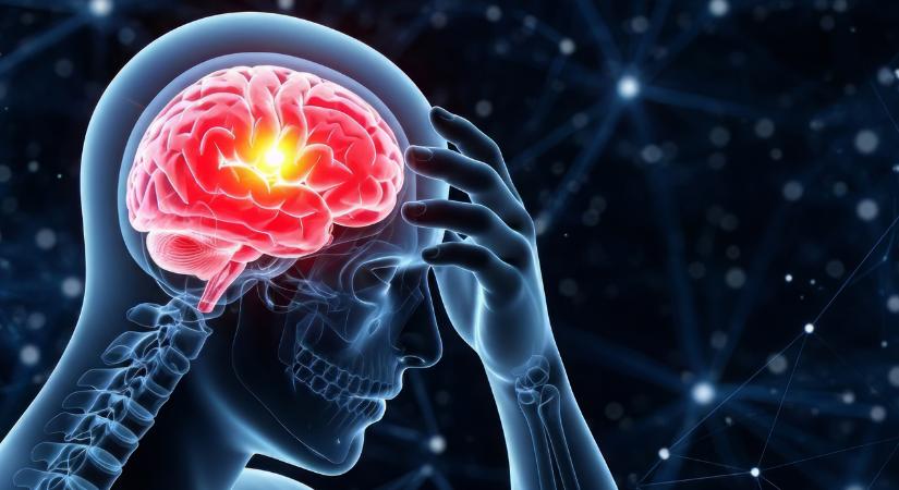 Megelőzhető-e a stroke?