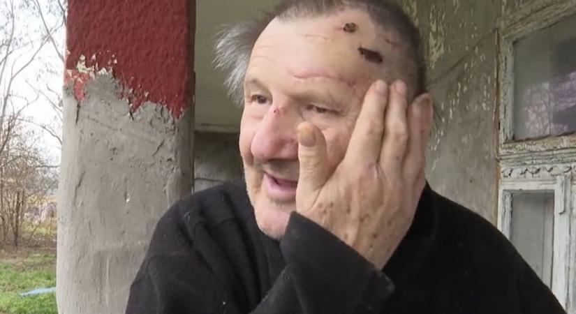 Dormándi rémálom – megtörten nyilatkozott a 76 éves nyugdíjas, akit lapátnyéllel vertek agyba-főbe  videó