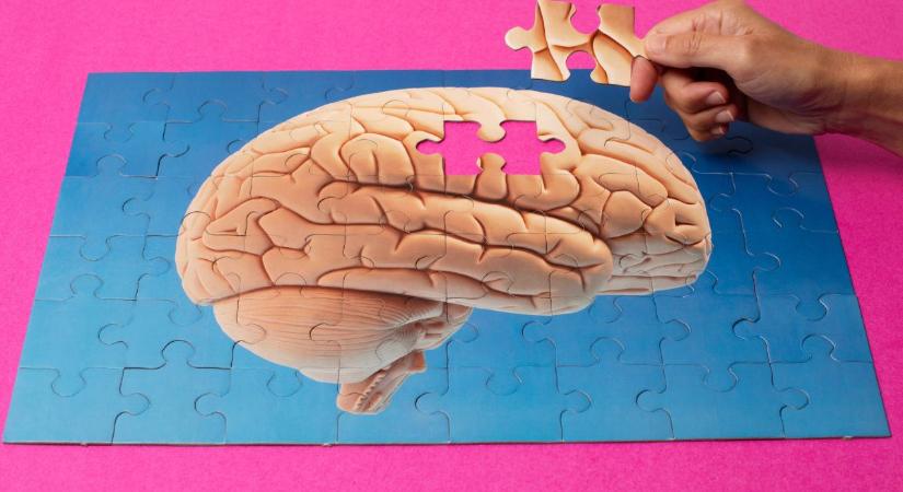 Te akarnád tudni vagy sem, lehet-e Alzheimer-kórod? Az orvosok ezt tanácsolják!