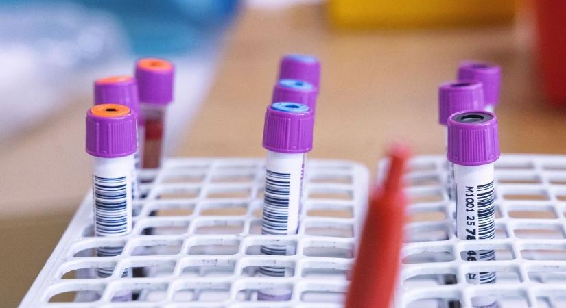 Életeteket menthetsz Hajdú-Biharban! Mutatjuk, hol és mikor segíthetsz