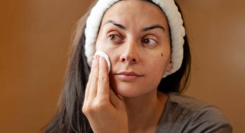 A 25 éves nő smink és filter nélkül mutatta meg bőrét - Ledöbbentek rajta a kommentelők