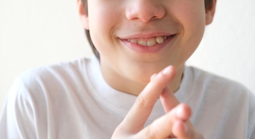 Megható csoda Nyíregyházán – Így vált valóra egy autista kisfiú álma