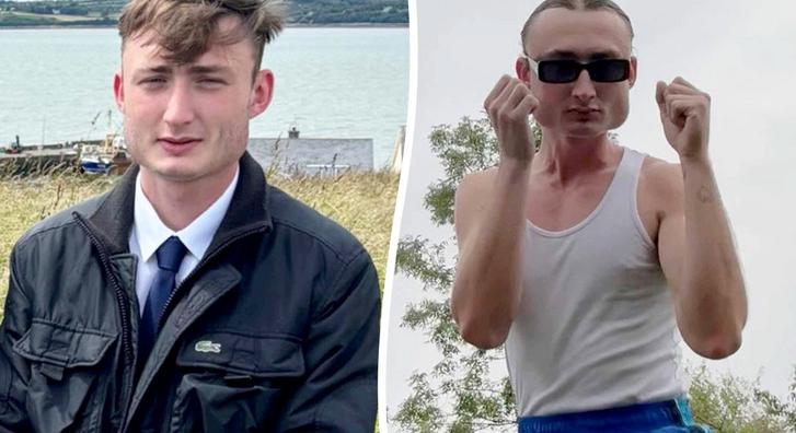 Brutálisan eldeformálódott a feje egy fiatal bokszolónak, így néz ki most sok év pusztakezes ökölharc után