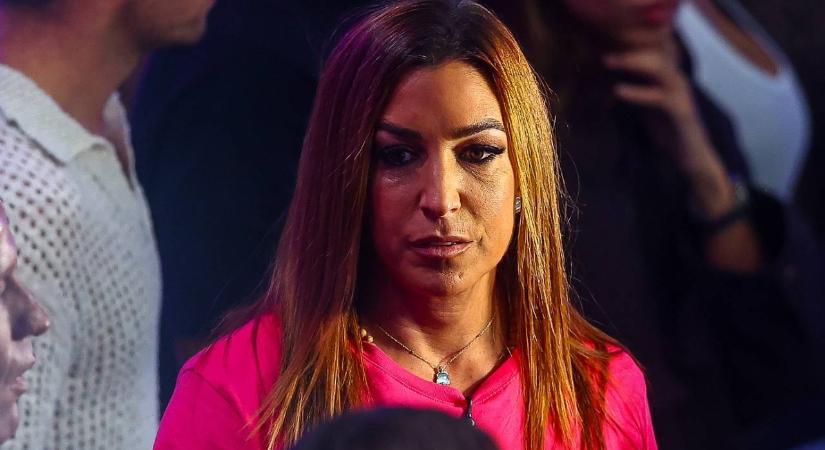 Rubint Réka a könyvében ír majd arról, hogy mi történt az arcával: „Rengeteg támadás ért”