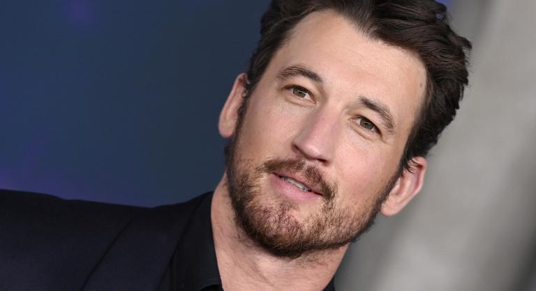 Durva átalakuláson ment át a Michael Jackson-filmben szereplő hollywoodi csillag