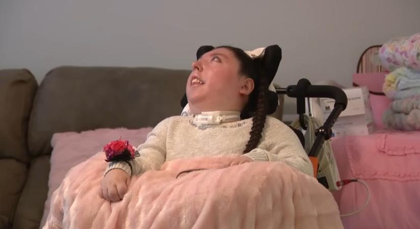 Orvosi csoda: 20 éves lett az agy nélkül született nő