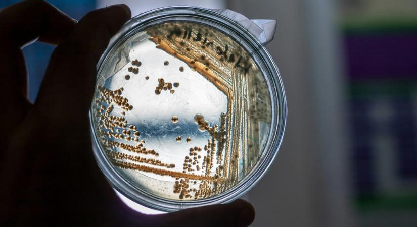 Meglepő felfedezés: egy hétköznapi szer segíthet legyőzni a szuperbaktériumokat