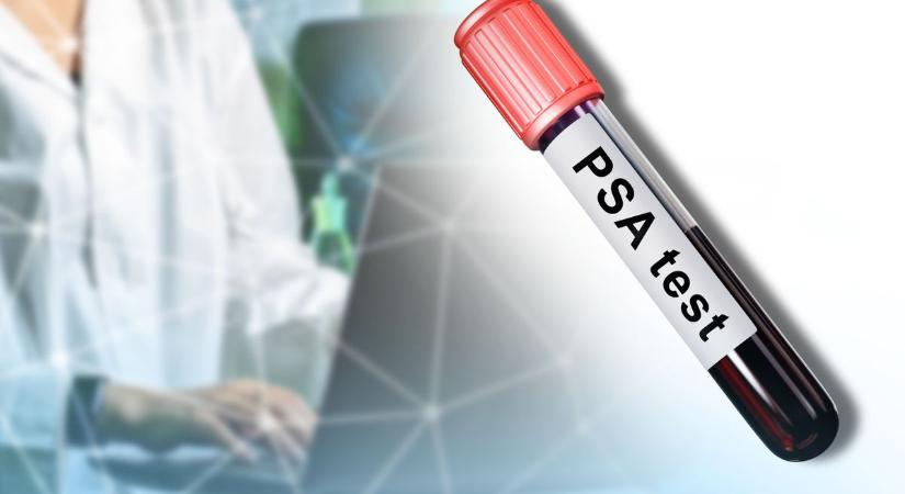 Lehet jelentkezni ingyenes PSA-szűrésre