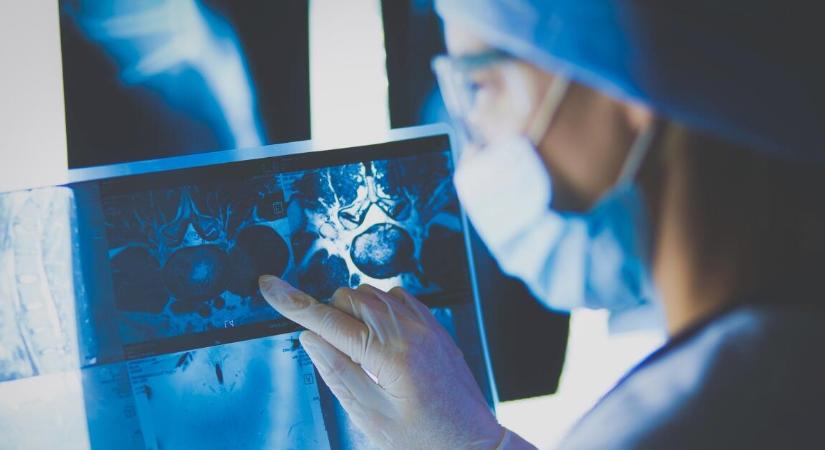 Aggasztó összefüggést találtak a fiatalkori vastagbélrákkal kapcsolatban