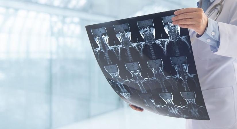 Műszaki hiba miatt szünetel a röntgenvizsgálatok nagy része a kórházban