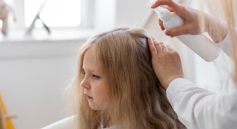 Fejtetvesség – mit érdemes tudnunk róla?