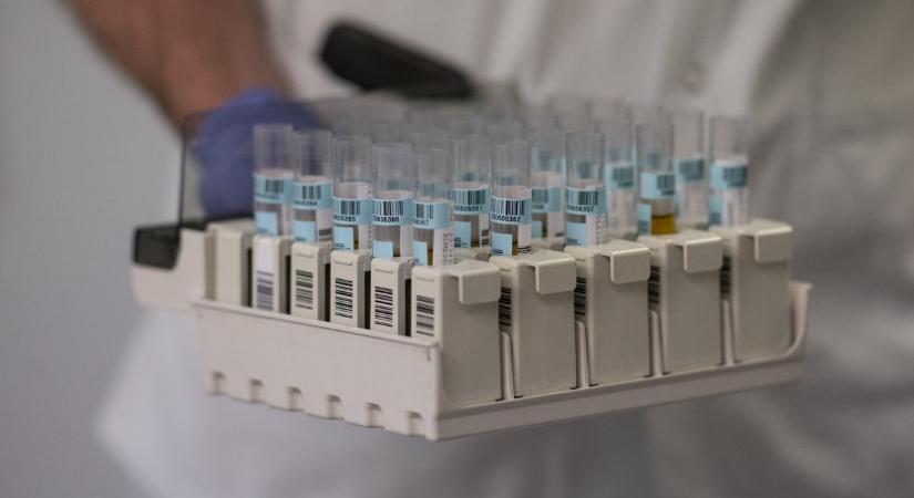 Magyar áttörés: az új rákgyógyszer teljesen meggyógyította a daganatos egereket