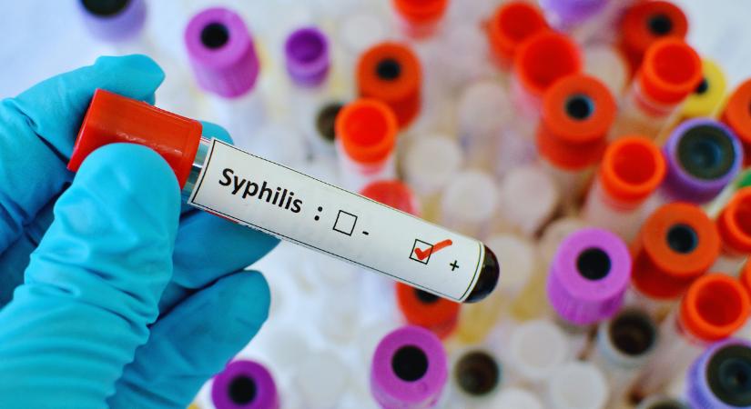 „Gyakorlatilag szifiliszjárvány van Magyarországon”