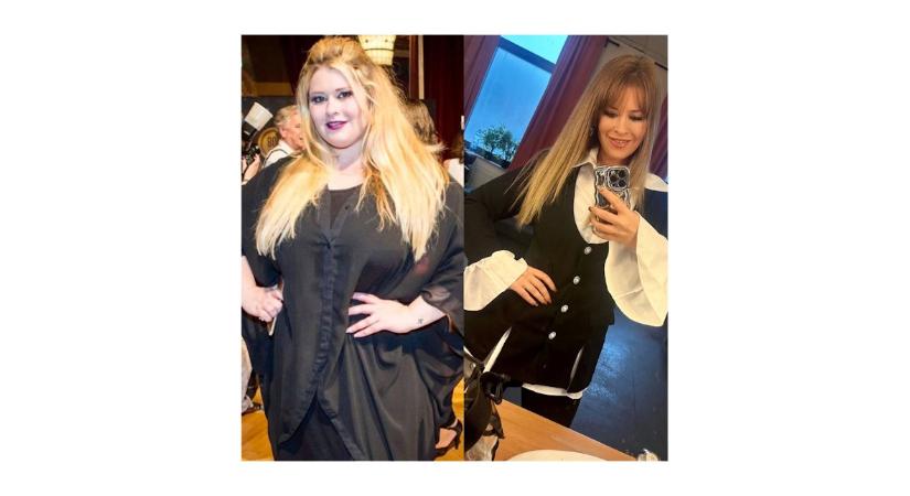 Diéta – Király Linda megdöbbentő fotókkal illusztrálja 22 kilós fogyását, de egyvalamit bevall: Még mindig harcolok