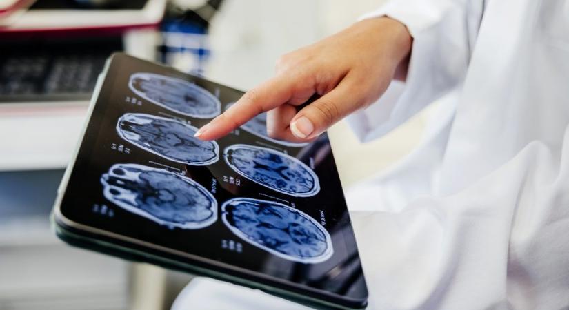 A szakértőknél is pontosabban felismeri az MI a testünkben az idegen anyagokat