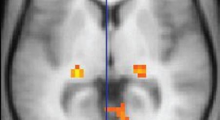 10 éve öltek met 132 fiatalt egy francia szórakozóhelyen – a túlélők agyát MRI-vel vizsgálják