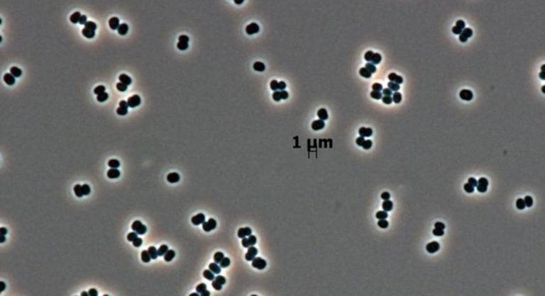 Halottnak tetteti magát a NASA baktériuma, a sterilizáció sem öli meg