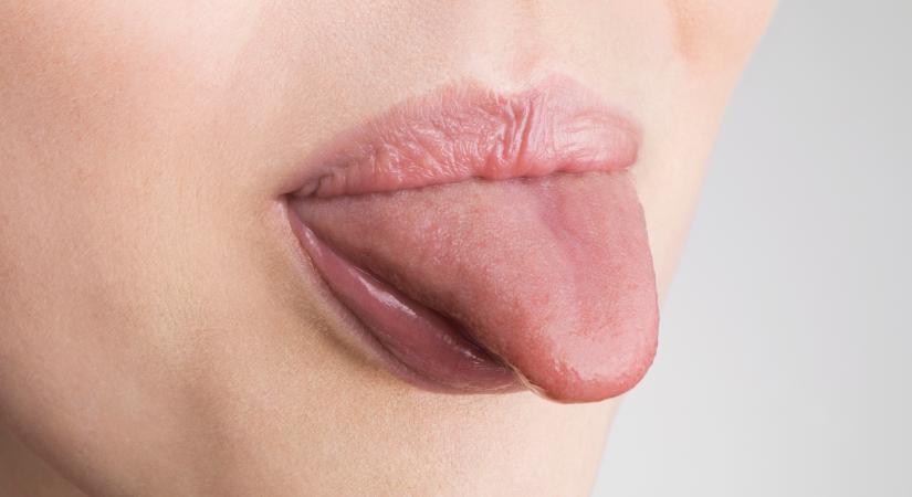 Milyen színű a nyelved? Többet árul el az egészségedről, mint hinnéd!