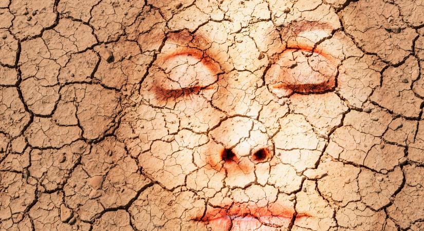 A szindróma, amitől magától kiszárad a test – nem is olyan ritka, mint gondolnád