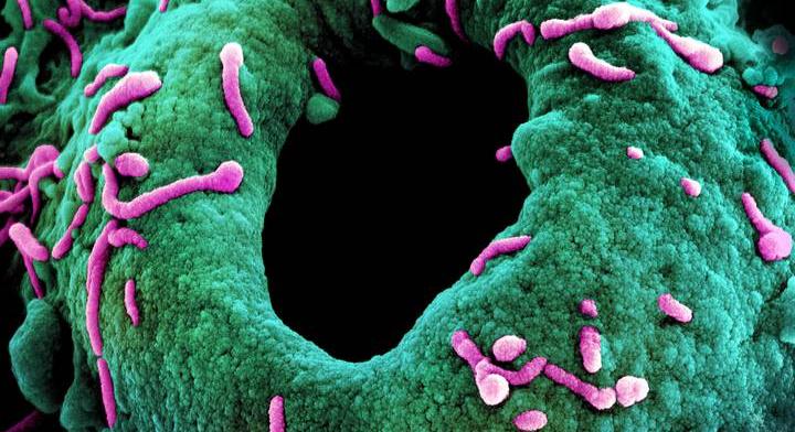 Halálos betegség szedi az áldozatait: az ebolához hasonlító vírus jelent meg Etiópiában