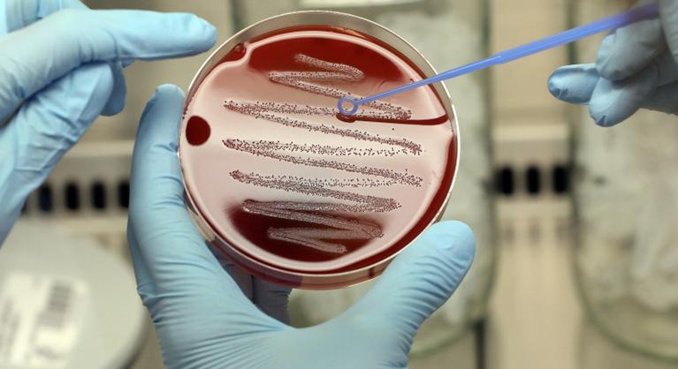 Antibiotikumoknak ellenálló szuperbaktériumok terjednek Ukrajnában: már Európát is fenyegetik