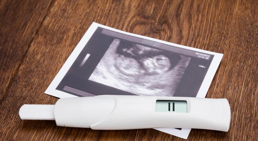 Könnyítés jön a CSOK Plusznál: ha jön a baba, nem számít az édesanya életkora