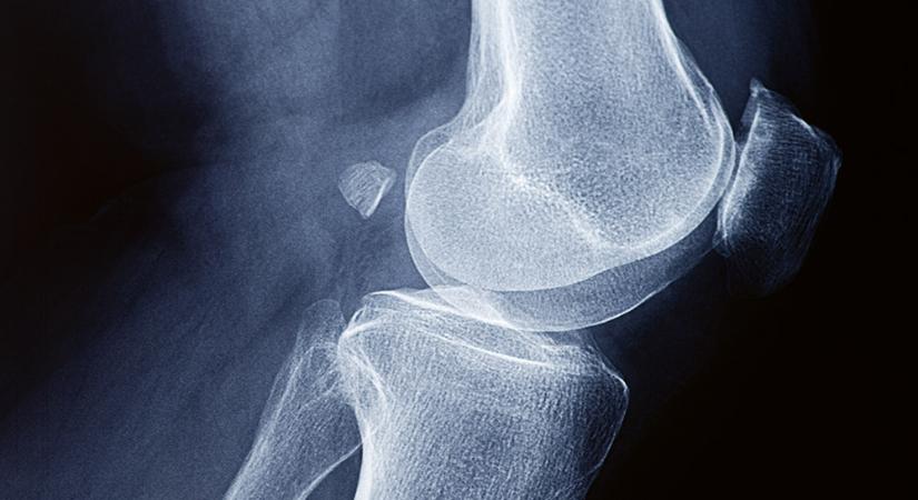 Minden pontosan a helyére kerül