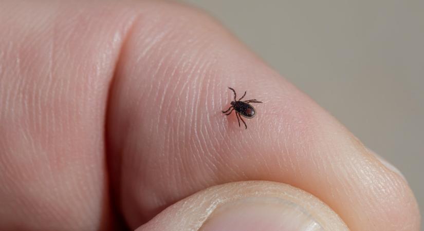 Egészen extrém allergiát okozott a kullancscsípés egy férfi szervezetésben – az életébe került