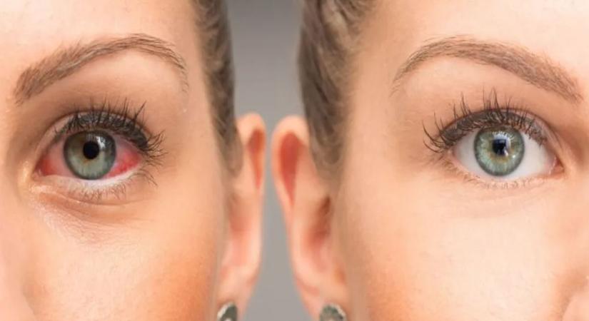 A látás megőrzésének egyik titka a jó minőségű szemészeti vizsgálat