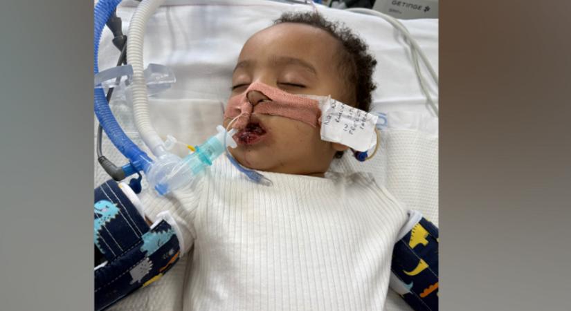 Szívszorító tragédia: Szívrohamot kapott és elvesztette fél nyelvét a 18 hónapos, aki lefolyótisztítót ivott tej helyett