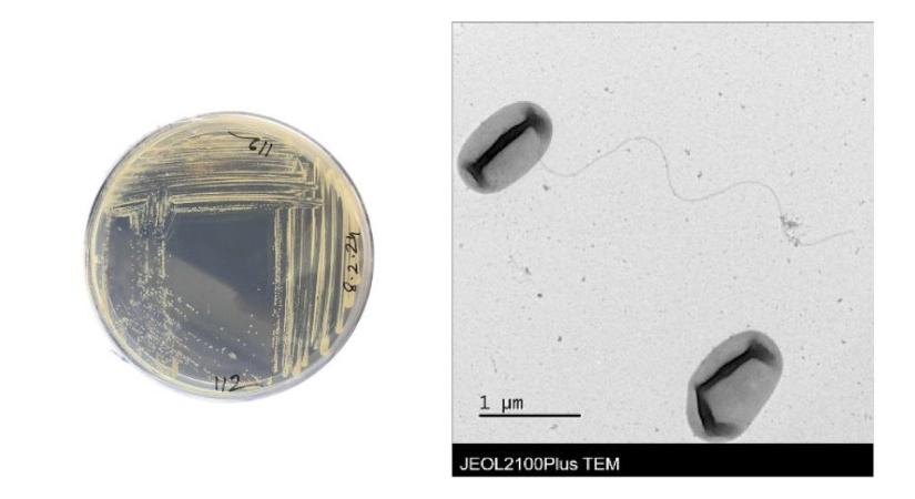 Ismeretlen baktériumot fedeztek fel magyar kutatók