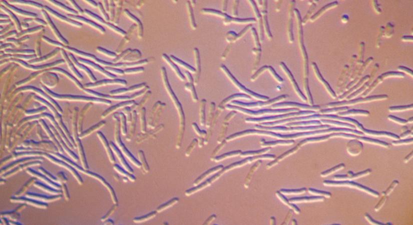 Szenzációs magyar kutatás: új baktériumfajt azonosítottak, ez sok mindent megváltoztat