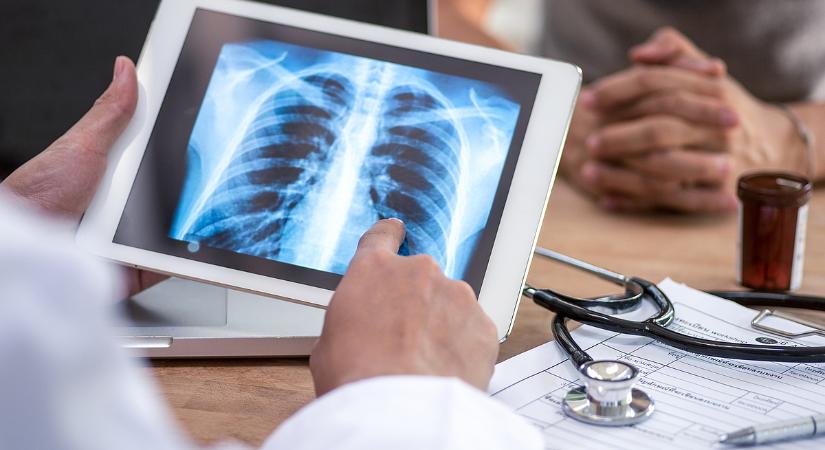 Tüdőbetegség, ami lopakodva öl: Magyarországon több százezren vannak veszélyben