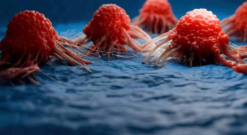 Magas a rák kockázata a családban? Így csökkenthető a rizikó