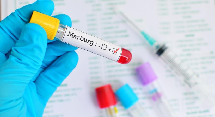 Rusvai Miklós: Európa sincs teljes biztonságban az Ebolához hasonló halálos kórral szemben