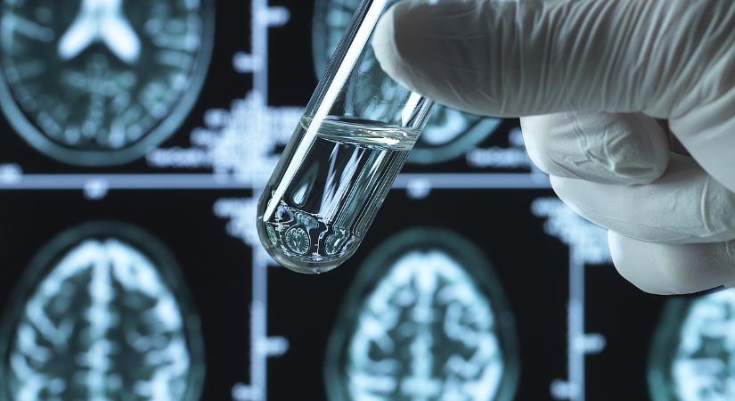 Ez a betegség megállíthatatlanul terjed: különösen a nyugdíjasokra jelent súlyos veszélyt