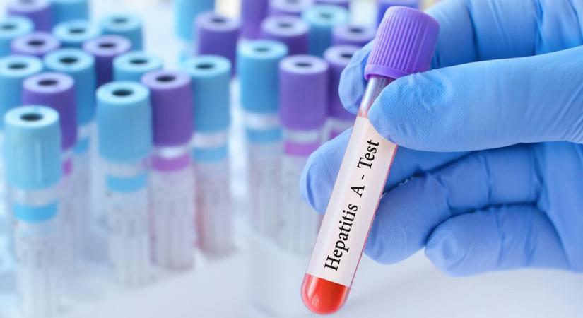 Ritka vírus robbantott járványt Magyarországon – 3 lépéssel leküzdhető a hepatitis A