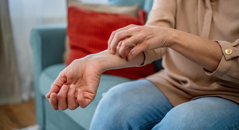 Ez lehet a bőrirritáció és a kiütés lelki oka