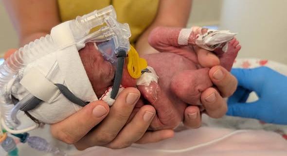 690 grammal született Alexa, végre hazamehetett!